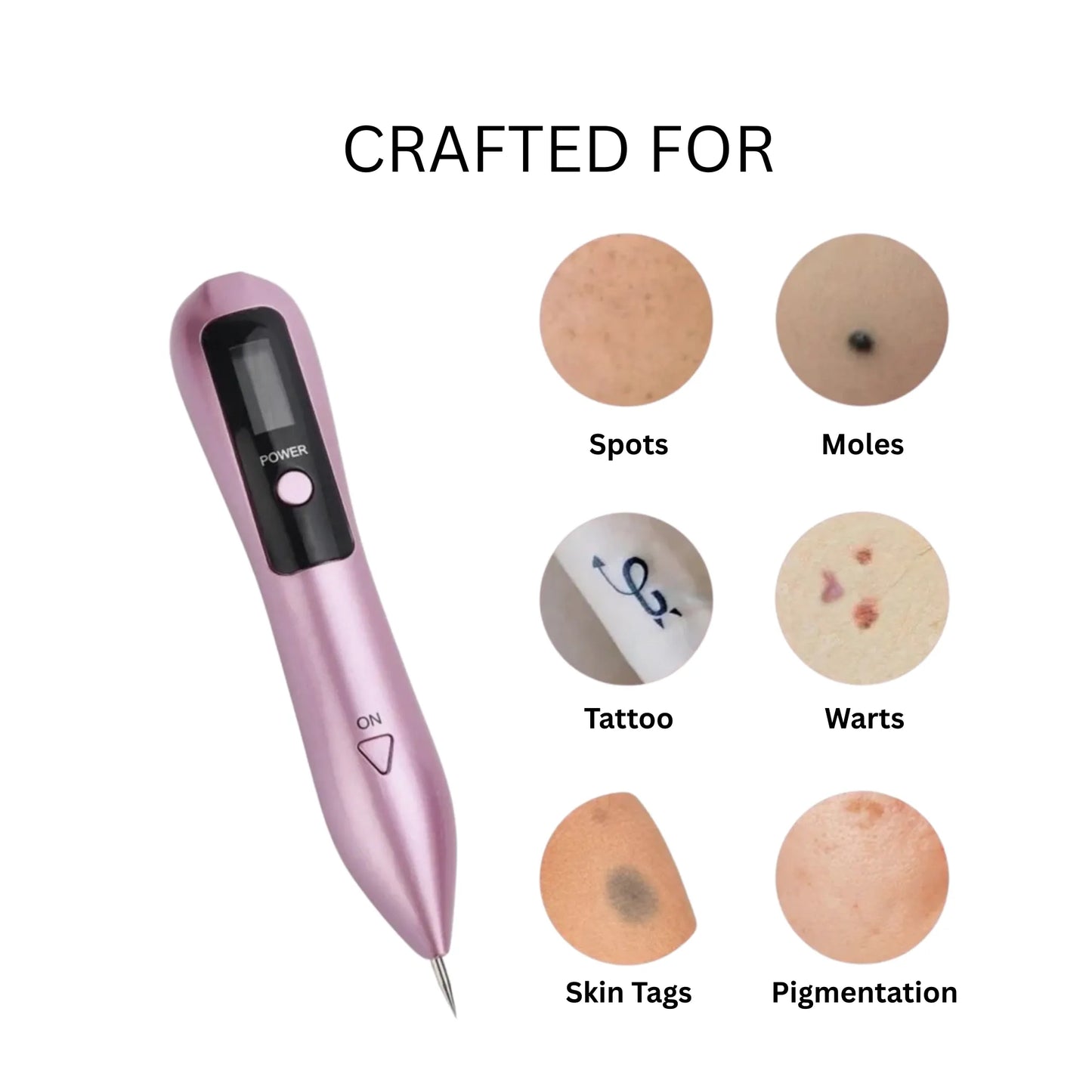 Skin Tag Remover Pen – Safe At-Home Use