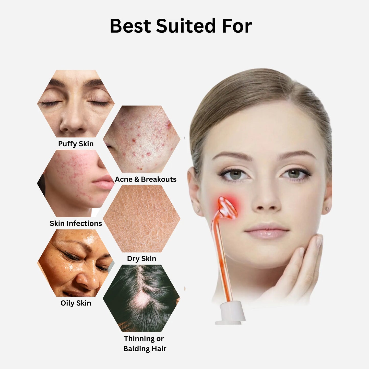 High Frequency Facial Wand – Acne & Wrinkle Treatment