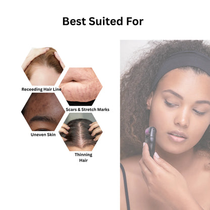 Microneedle Derma Roller – Skin Renewal Tool